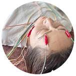 はなもも美容鍼