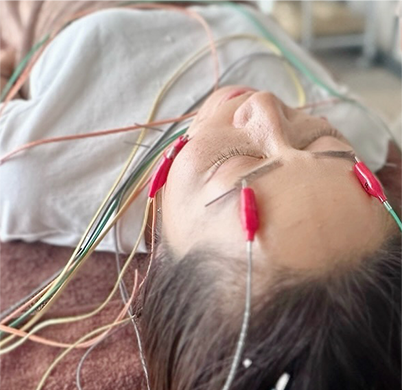 お顔の筋肉や神経にアプローチ。美人度アップの美容鍼をご提供